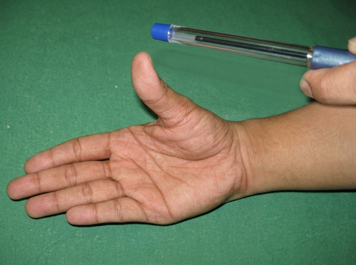 Image for question 535