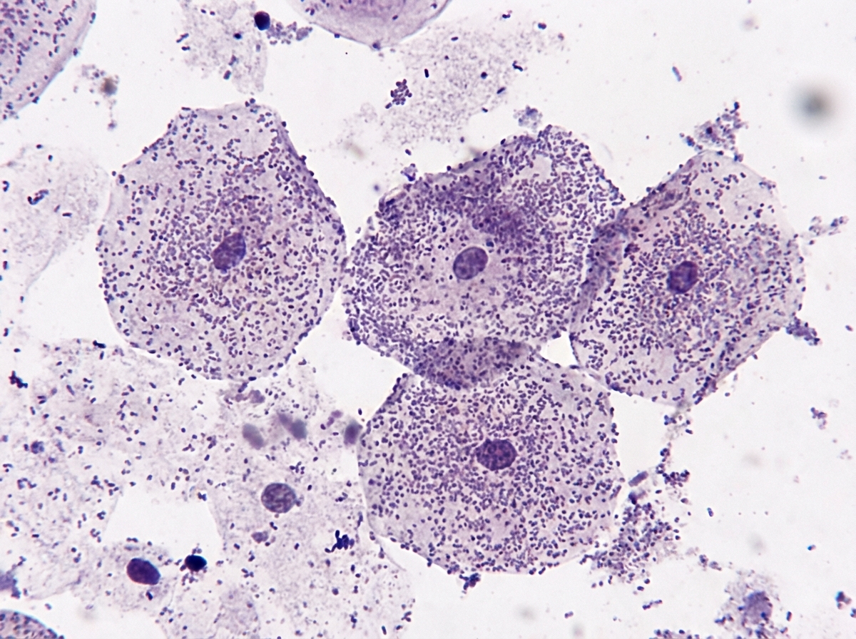 Image for question 1298