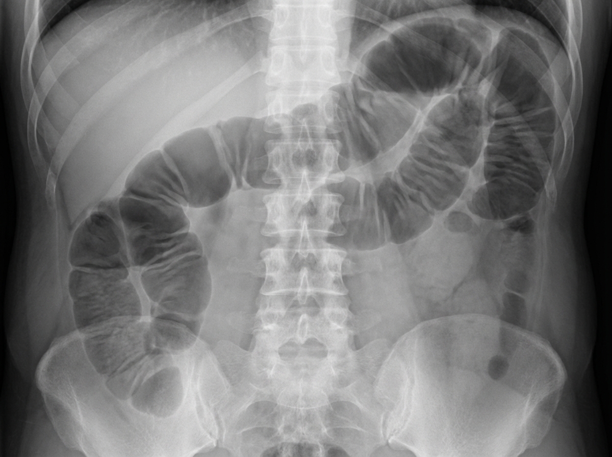 Image for question 108