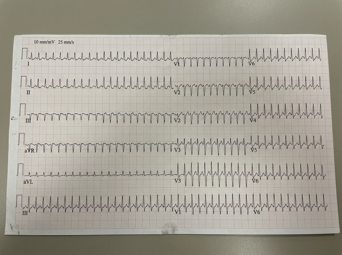 Image for question 4