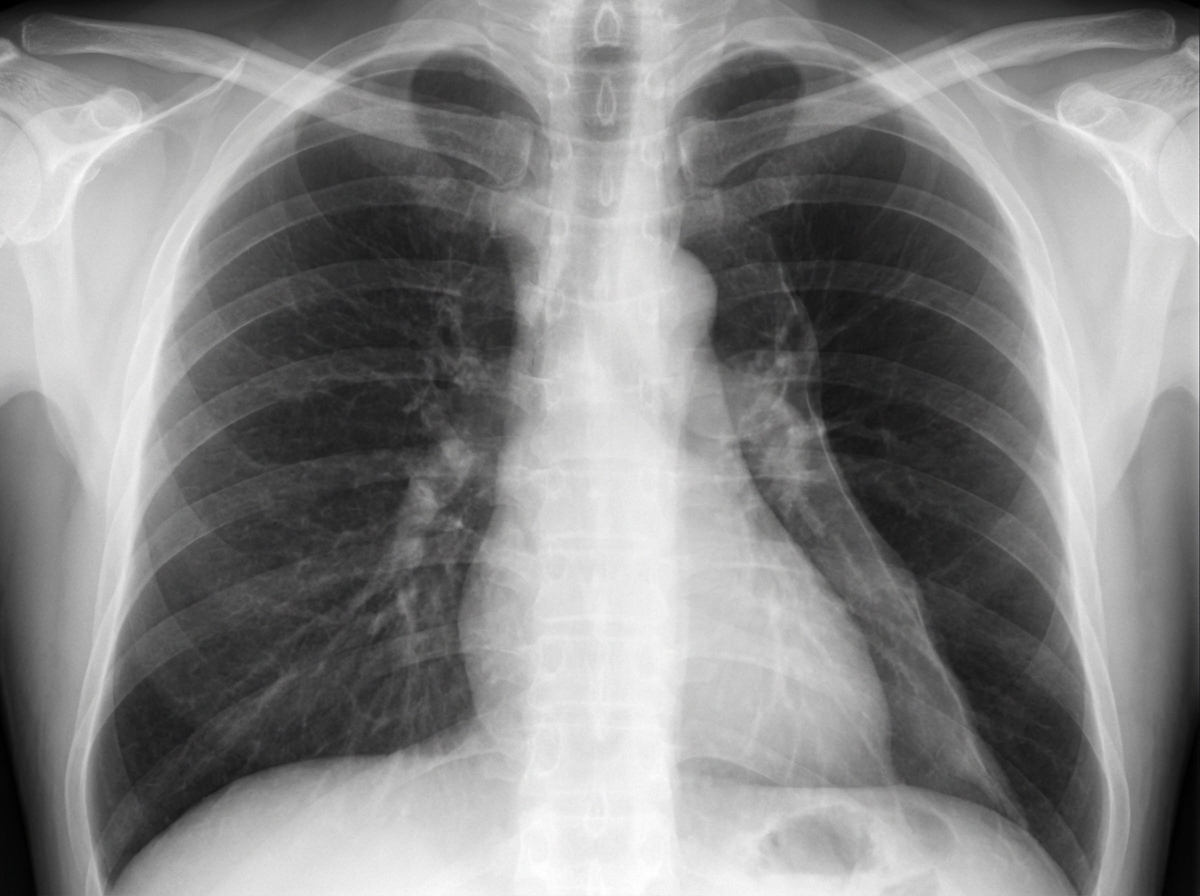 Image for question 4