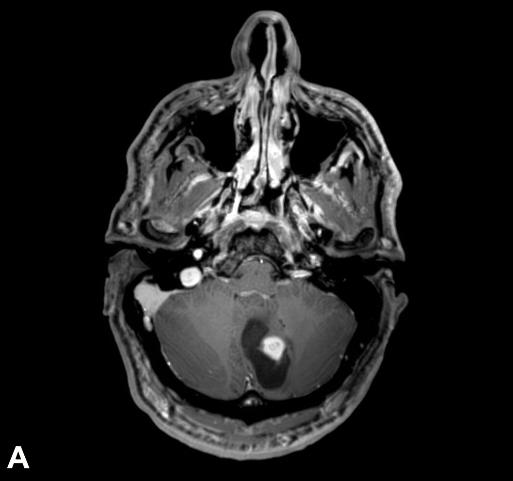 Image for question 31