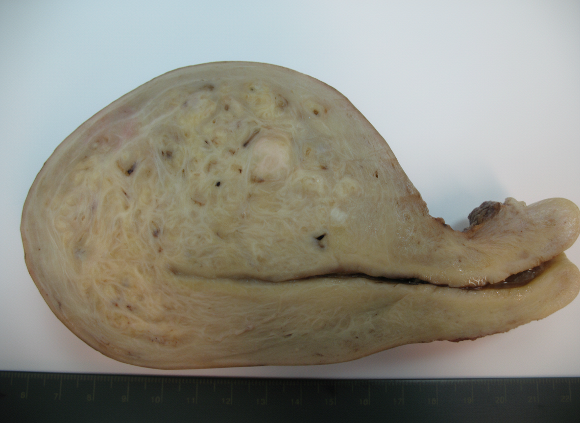 Image for question 161