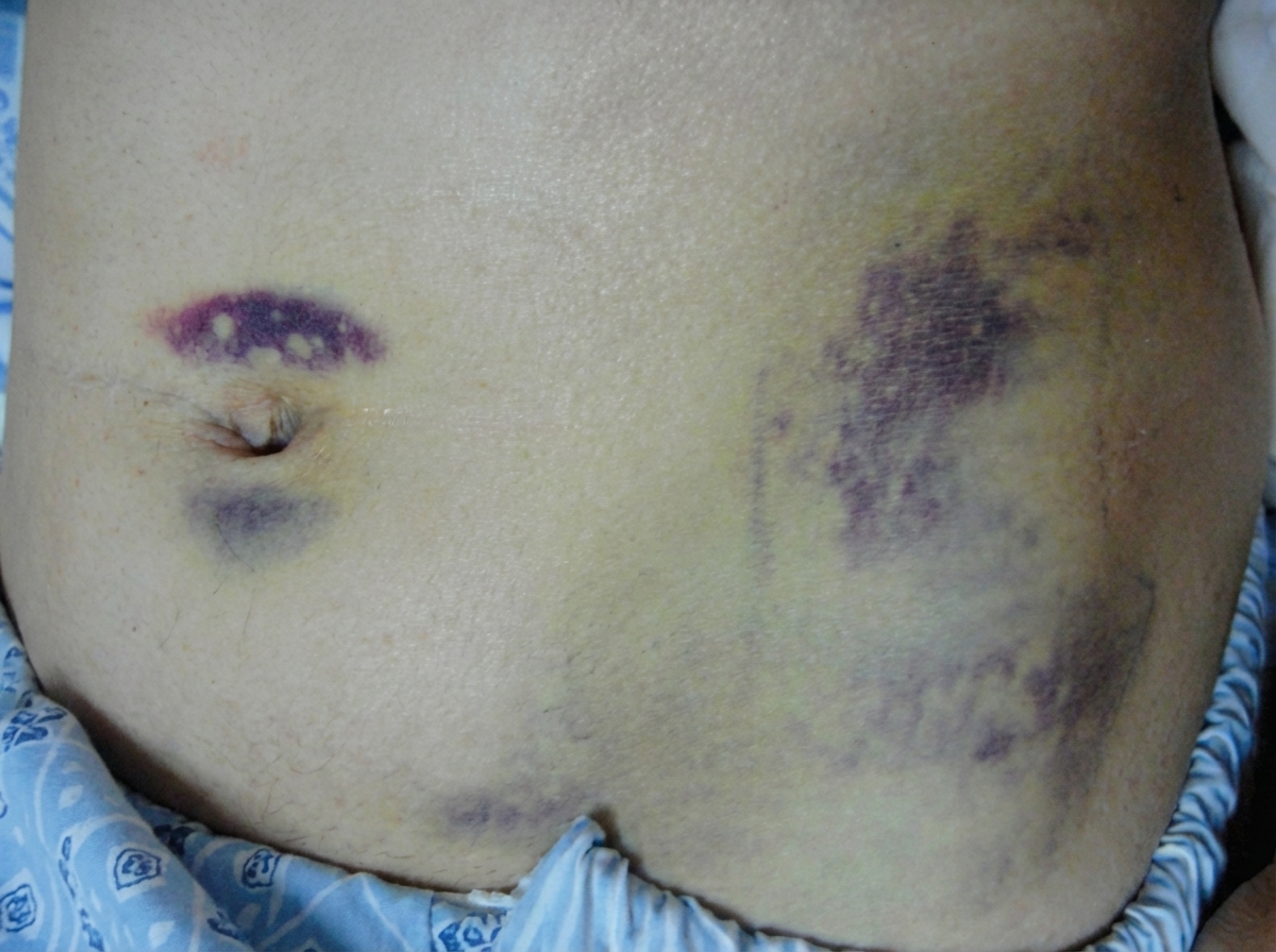 Image for question 218