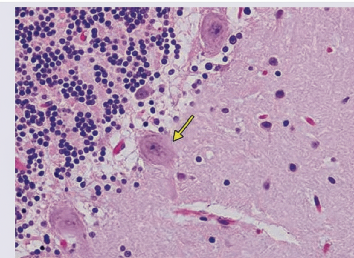 Image for question 129