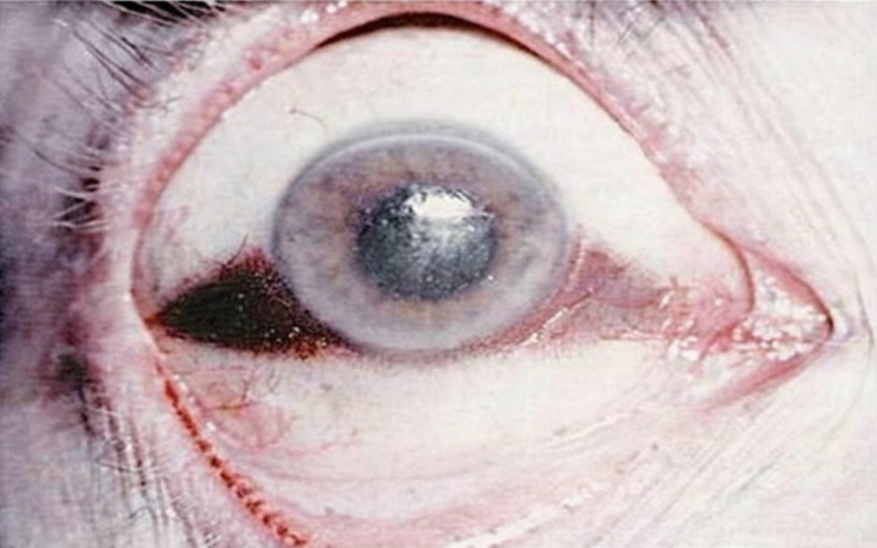 Image for question 148