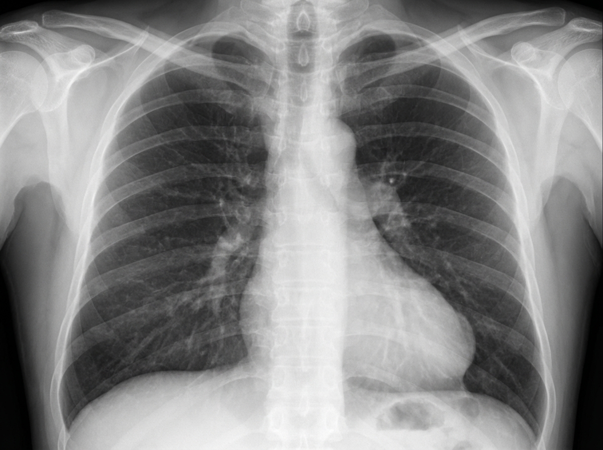 Image for question 203