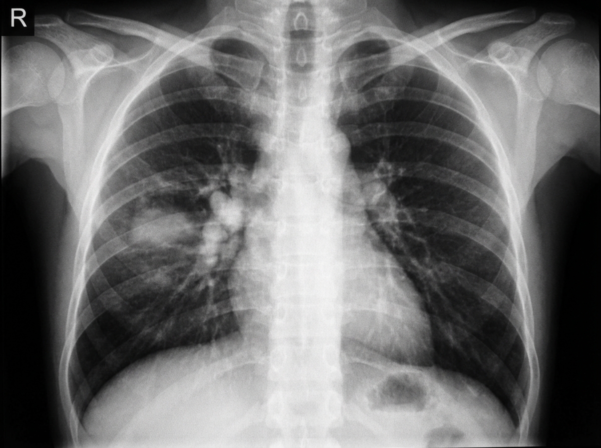 Image for question 122