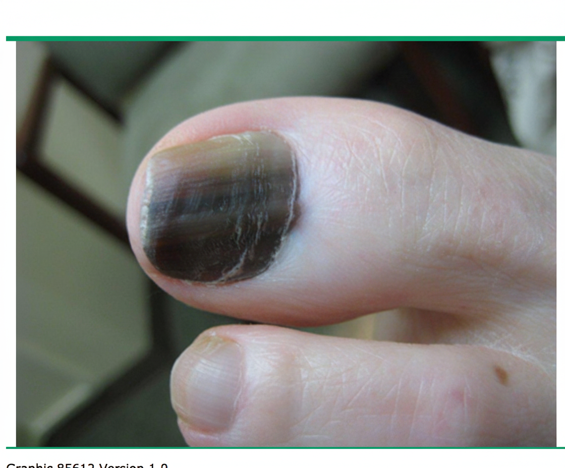 Image for question 54