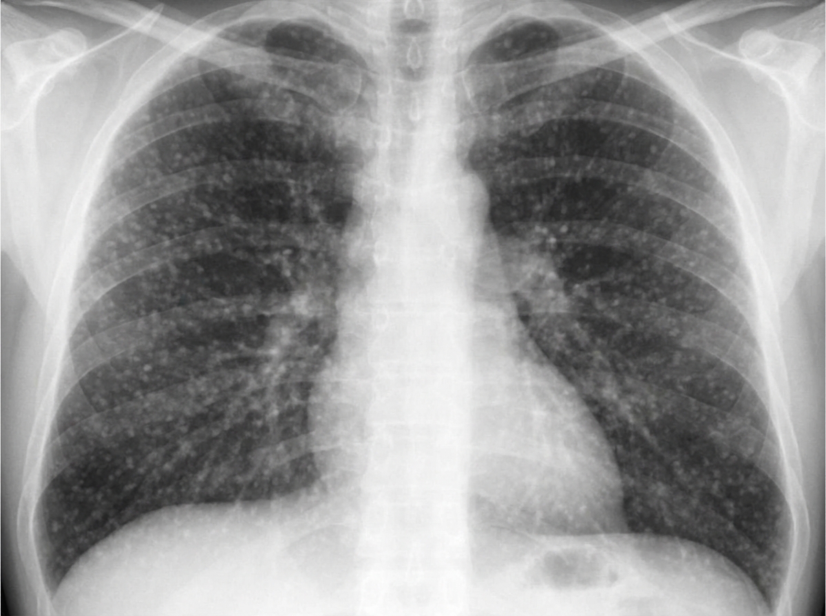 Image for question 209