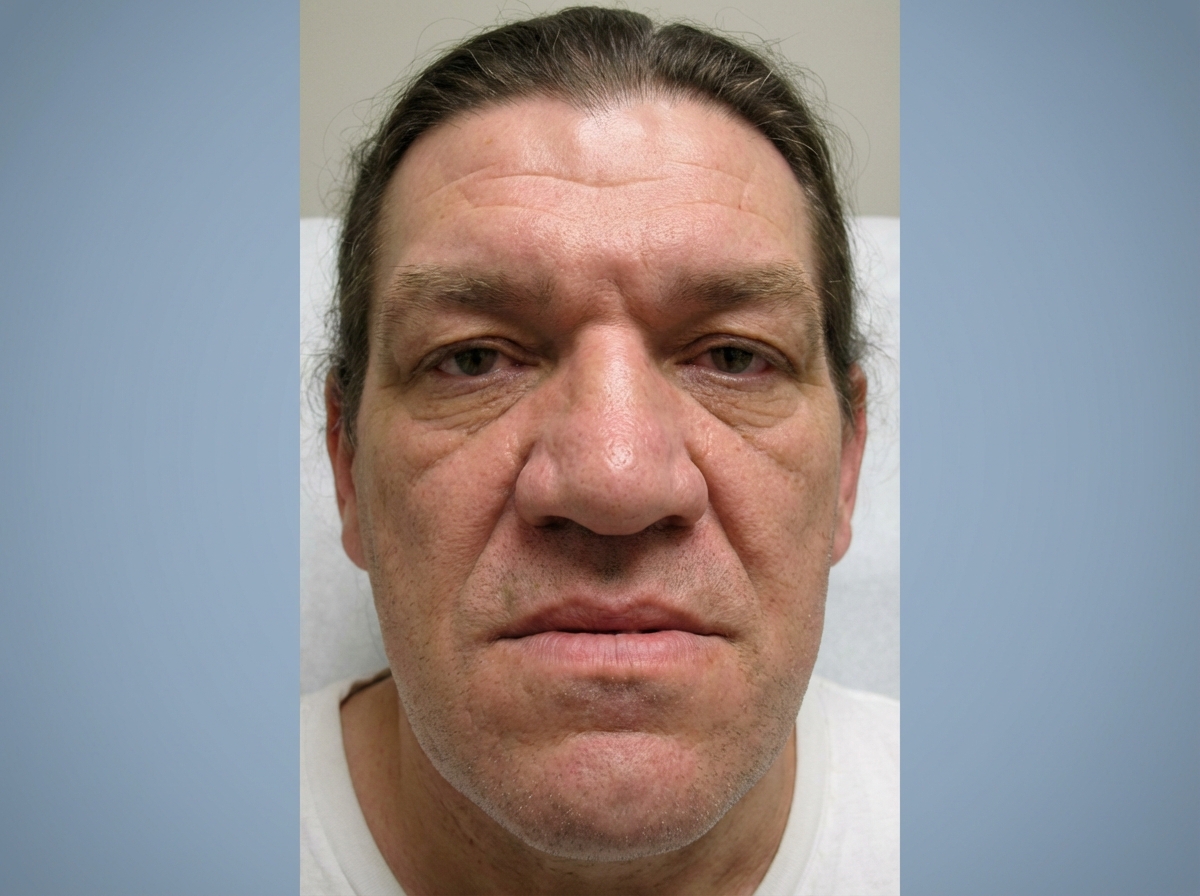 Image for question 980