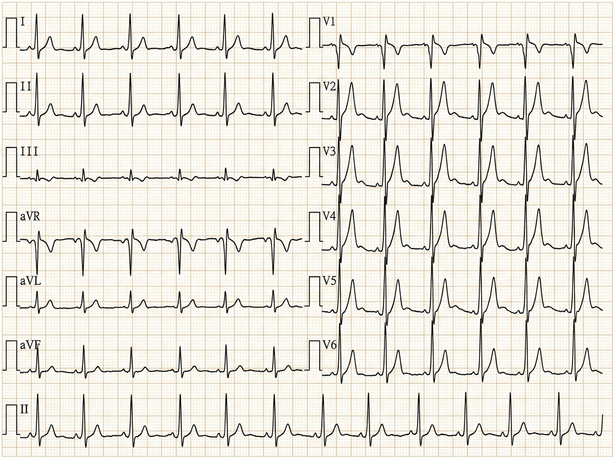 Image for question 1