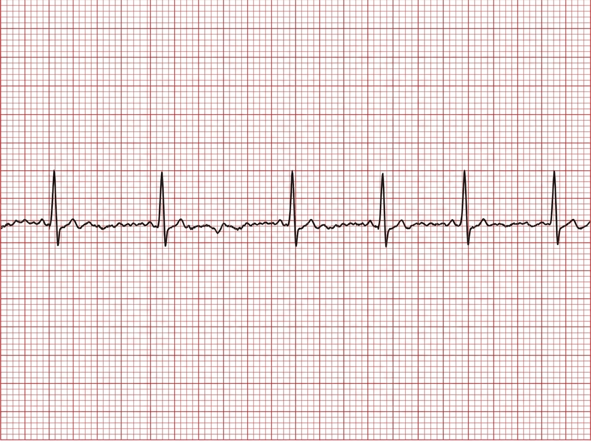 Image for question 1007