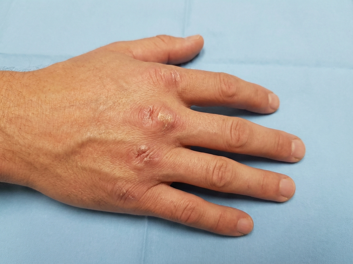 Image for question 46