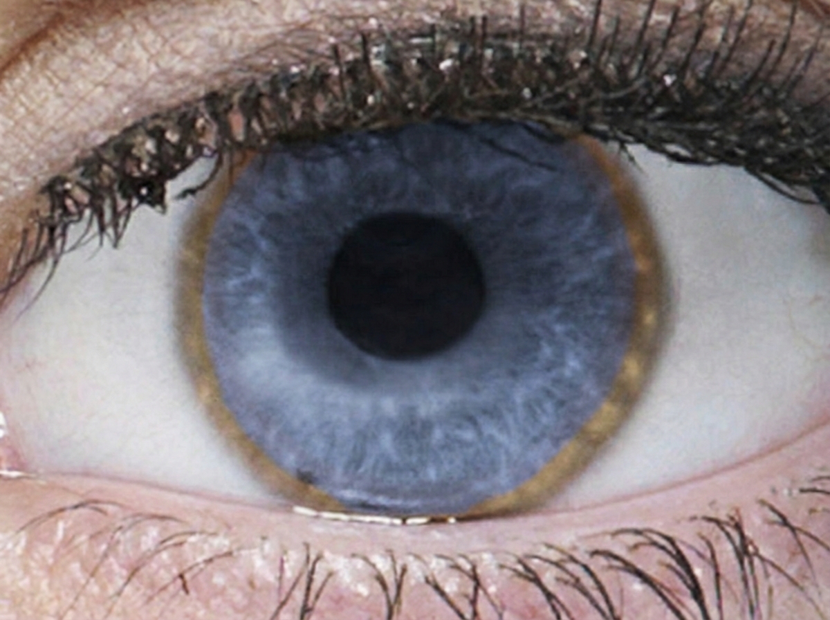 Image for question 75