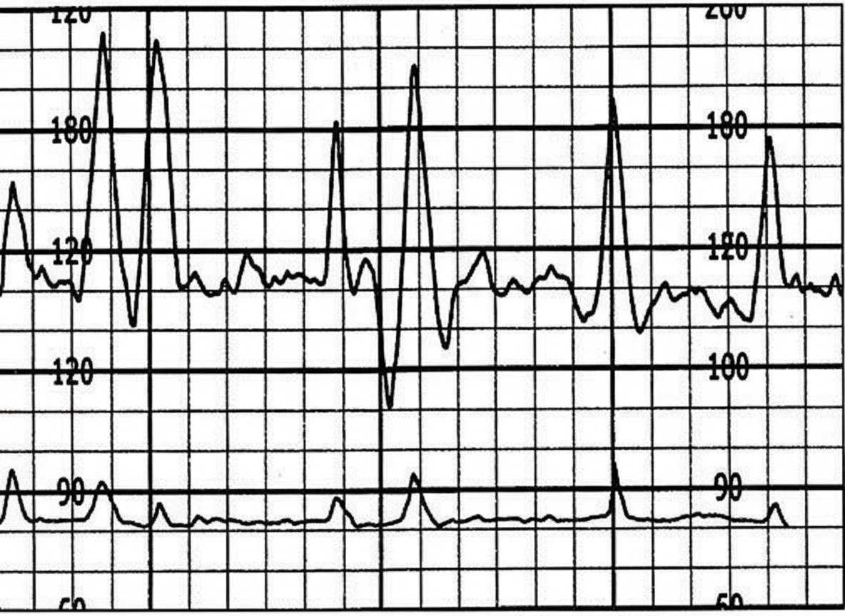 Image for question 812