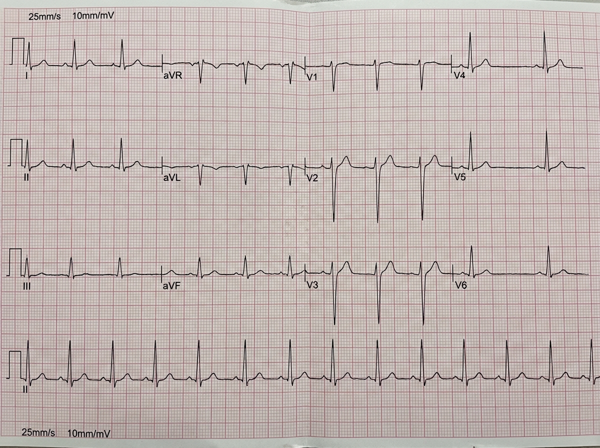 Image for question 903