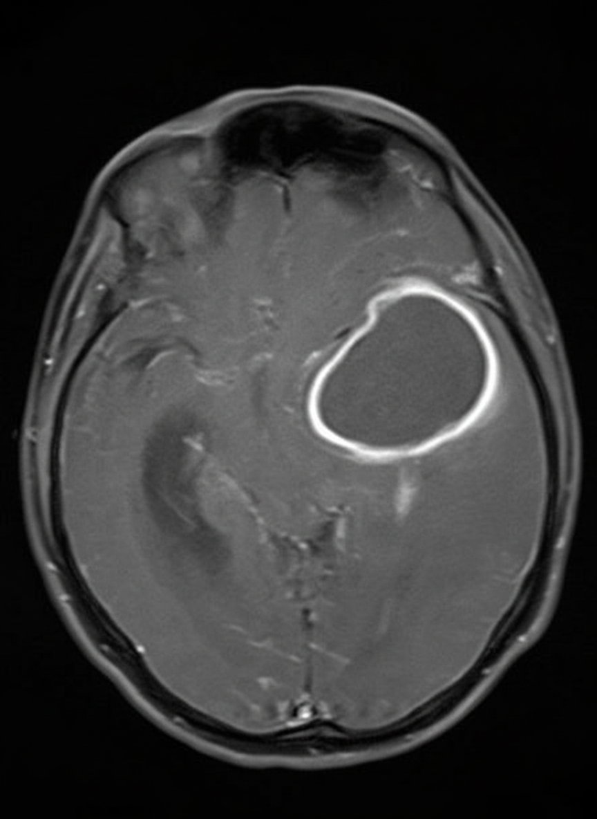 Image for question 53