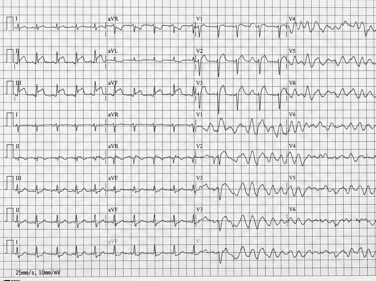 Image for question 1
