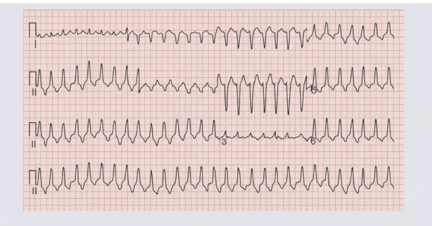 Image for question 1047