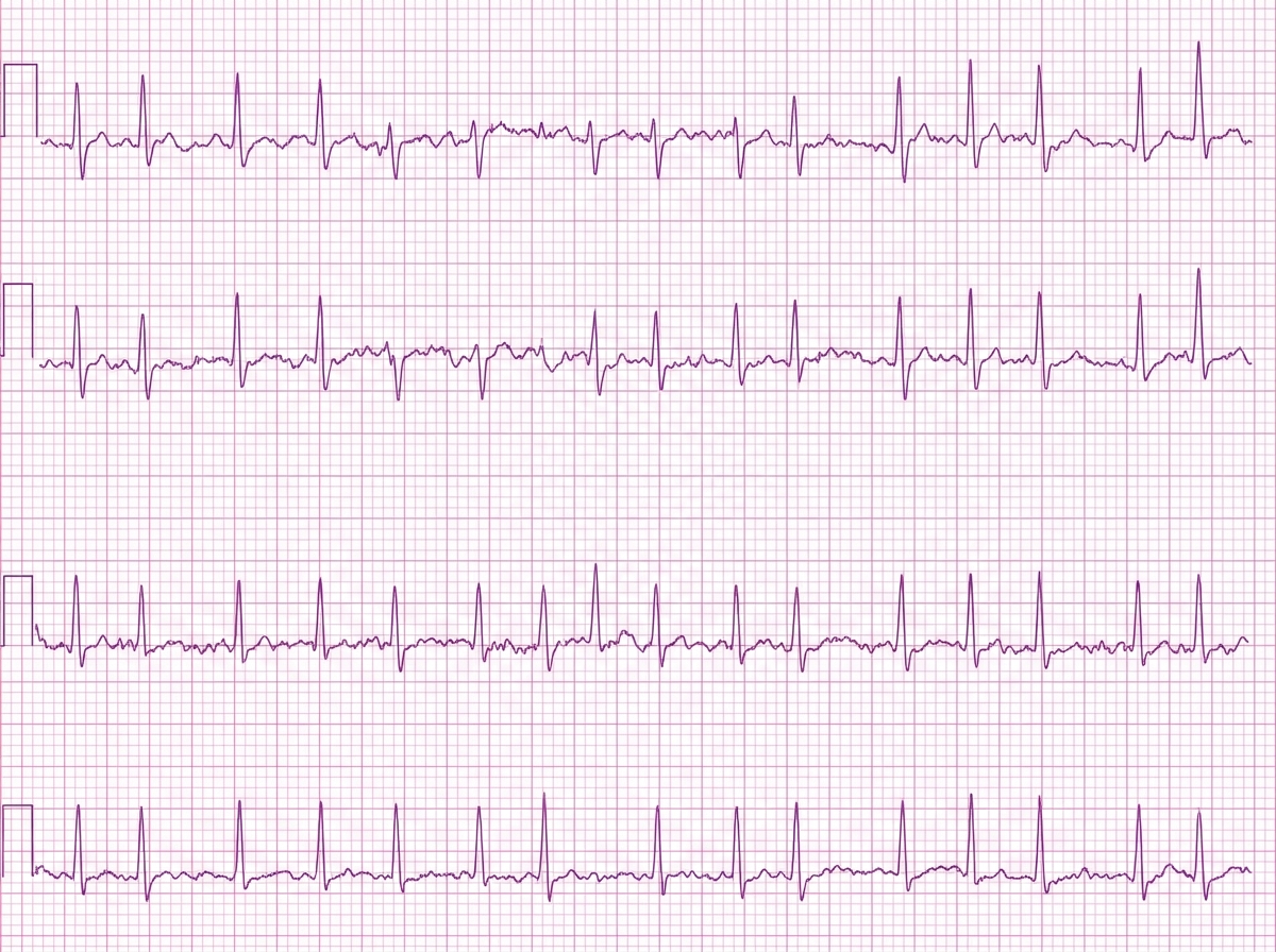 Image for question 25