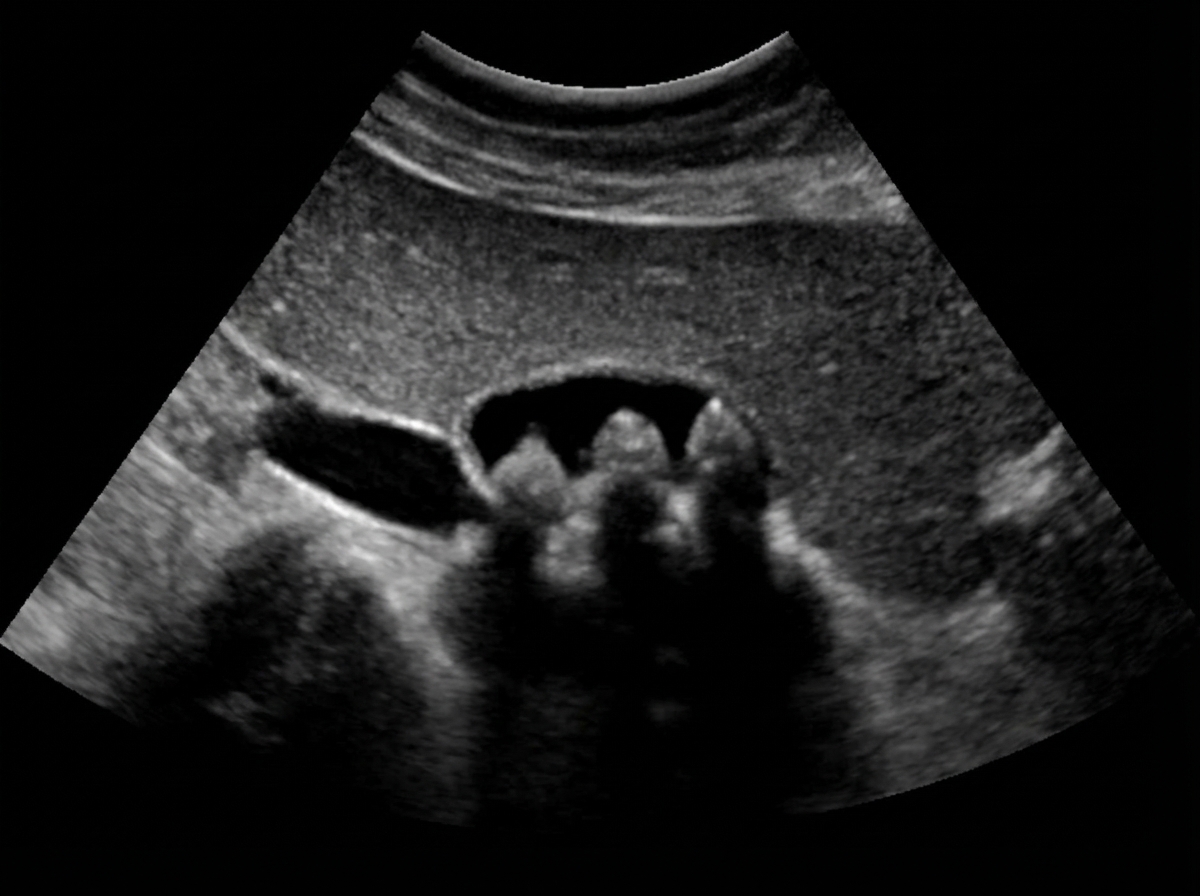 Image for question 440