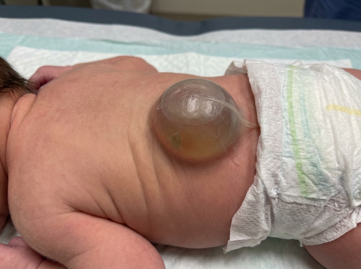 Image for question 170