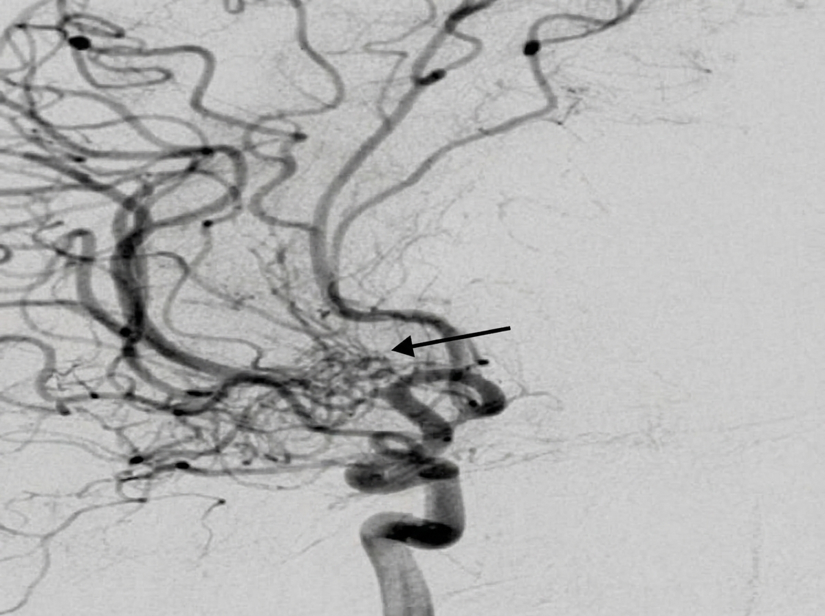 Image for question 189