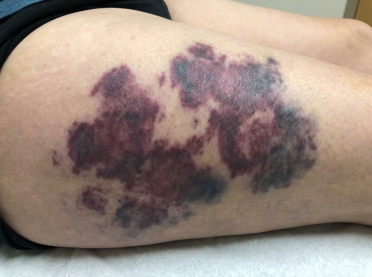 Image for question 512