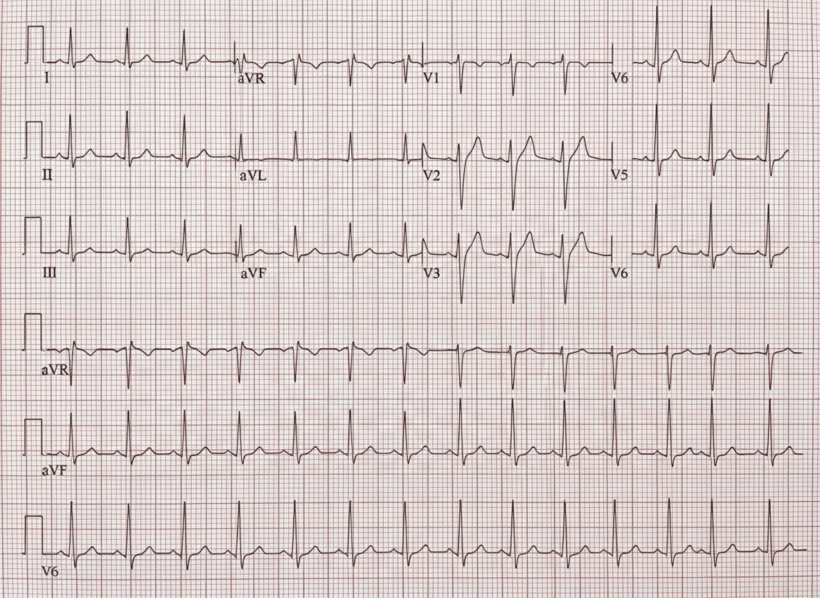 Image for question 403