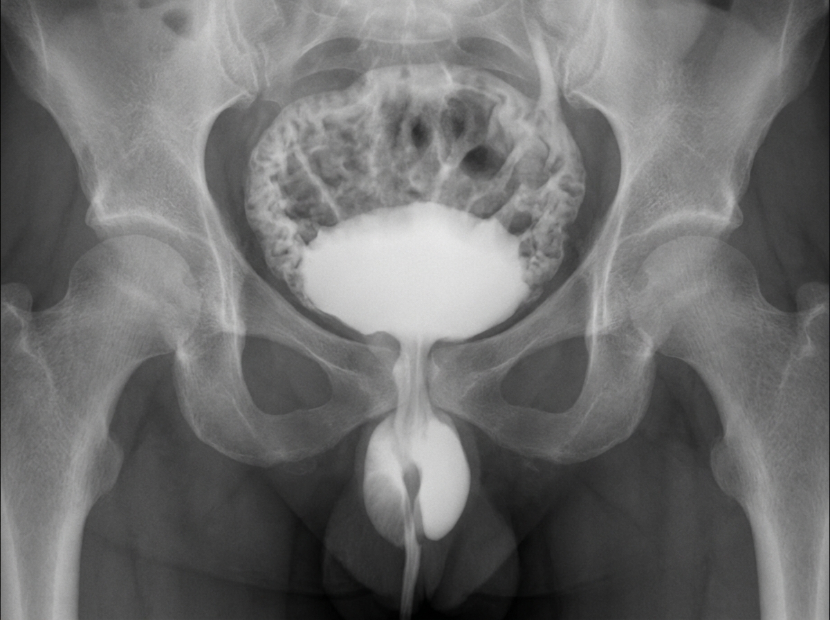 Image for question 47