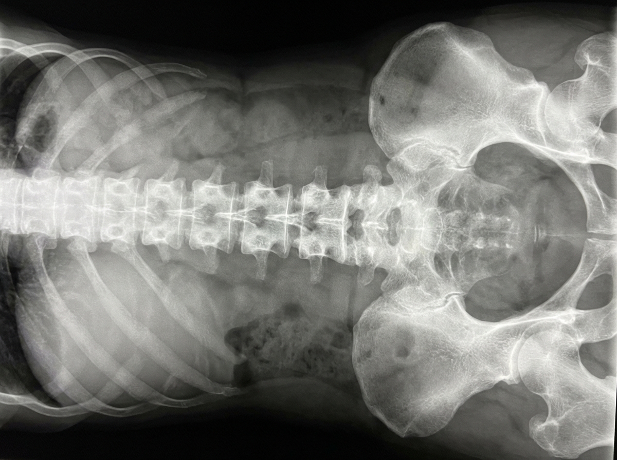 Image for question 178