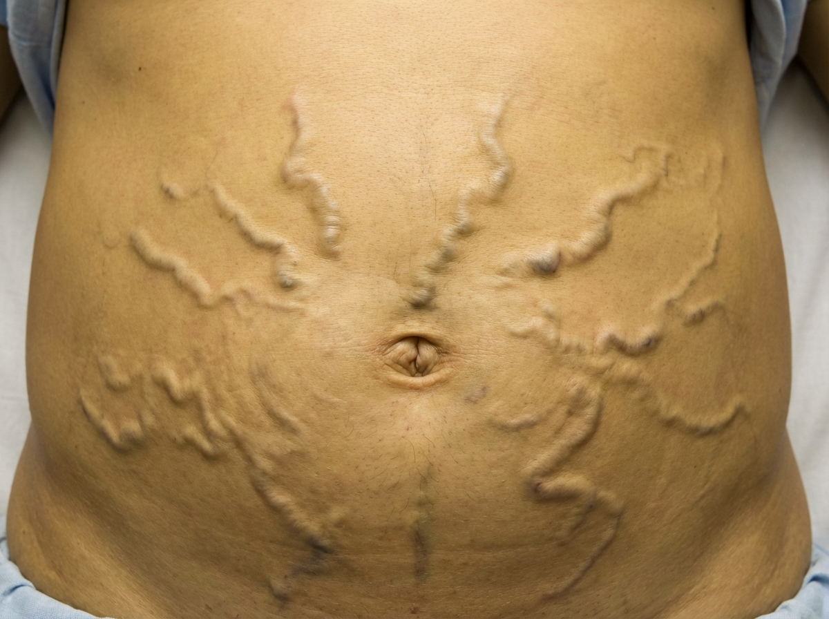 Image for question 396