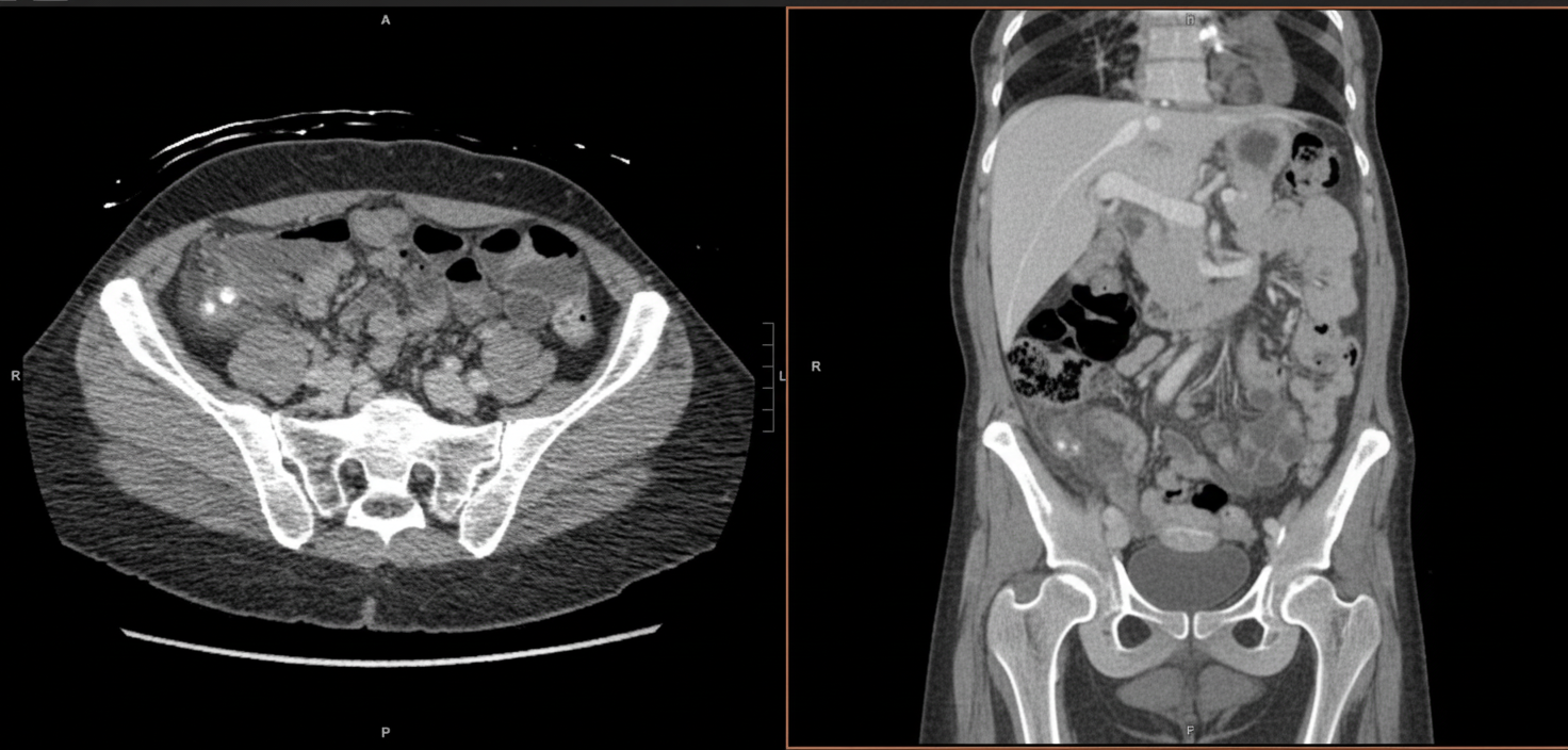 Image for question 272