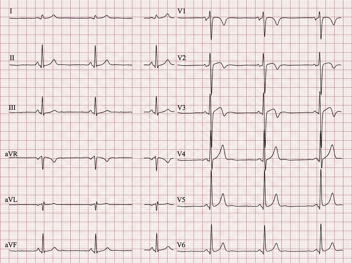 Image for question 17
