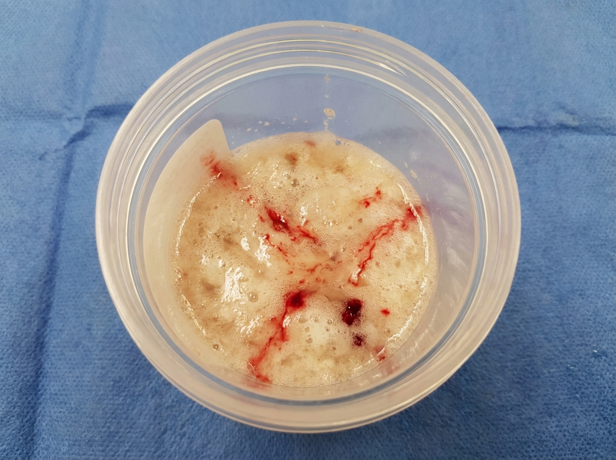 Image for question 189