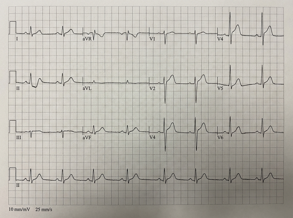 Image for question 34