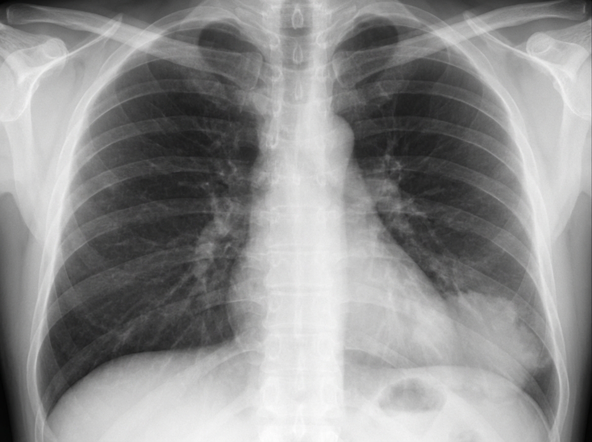 Image for question 400