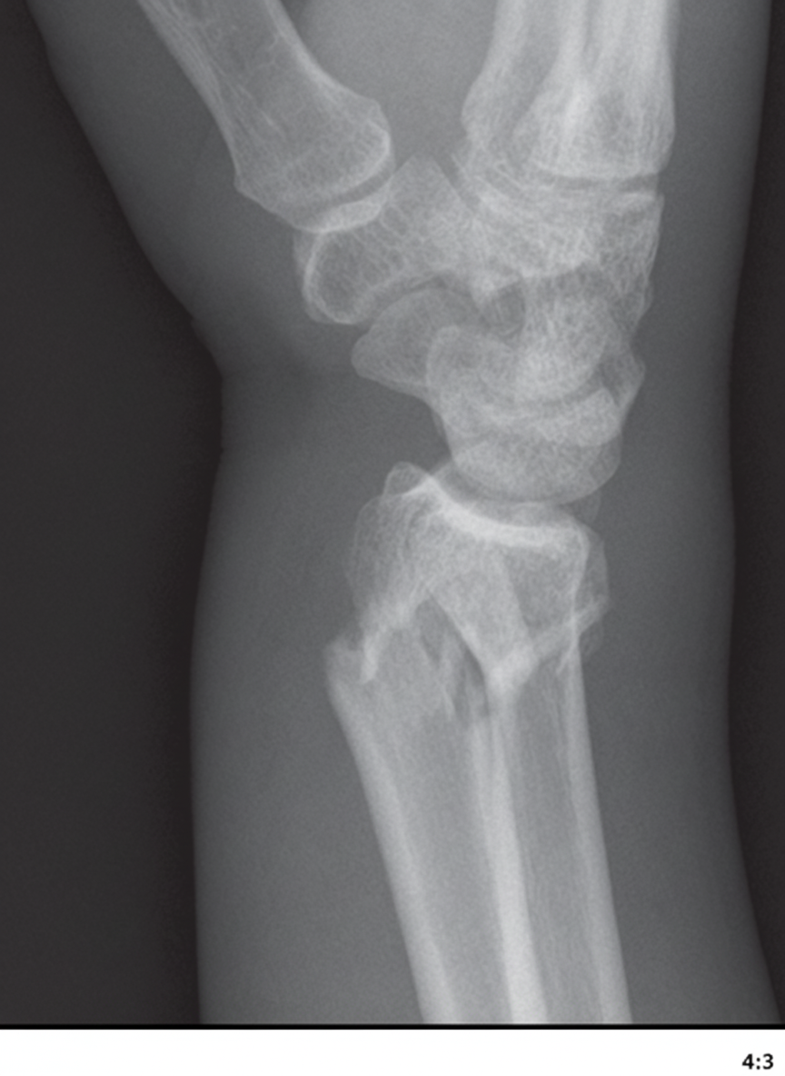 Image for question 364