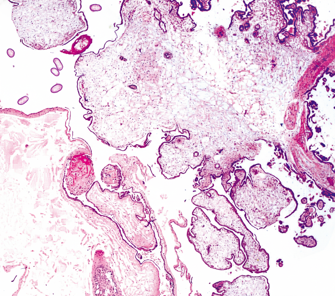 Image for question 193