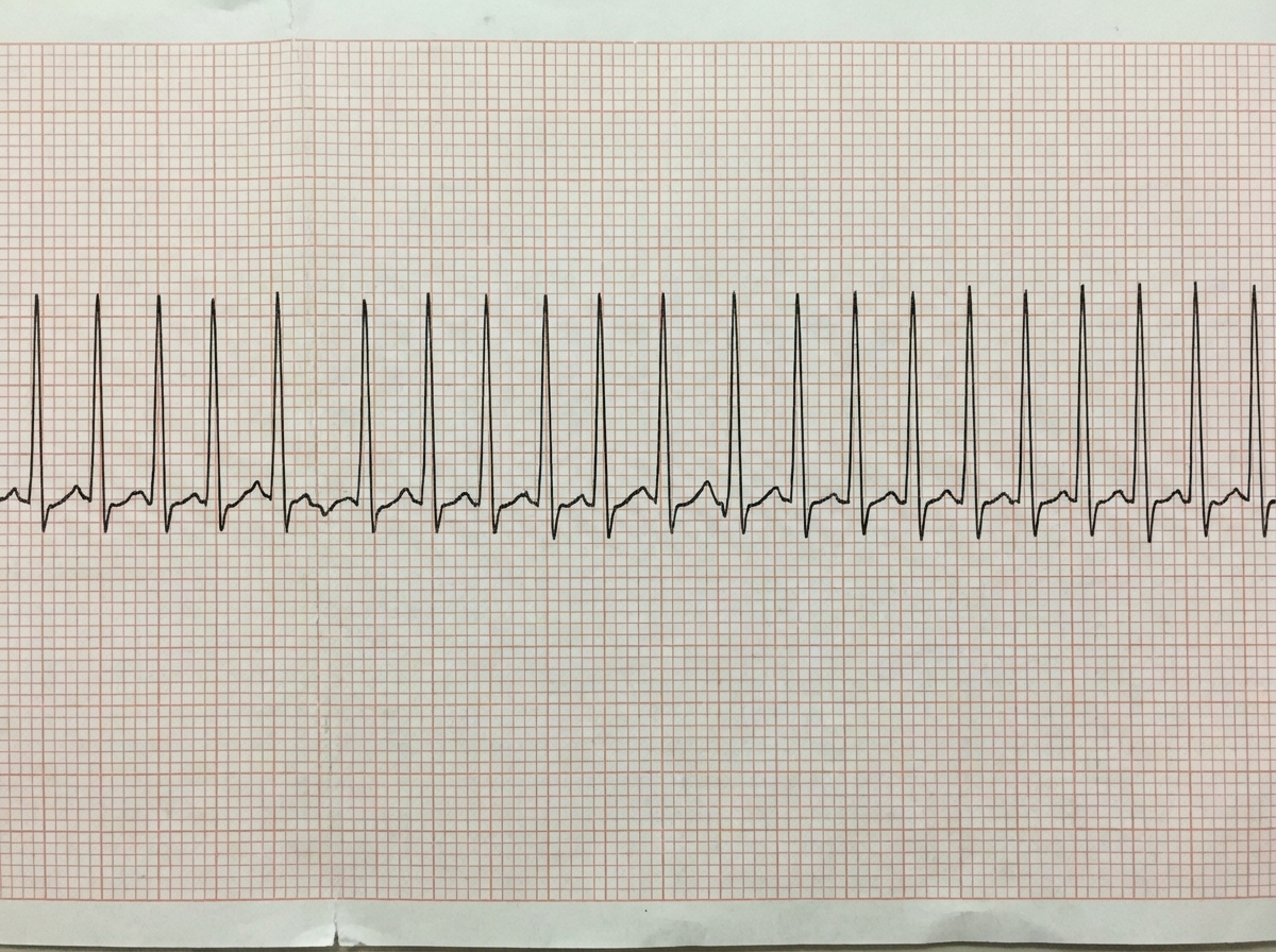 Image for question 22
