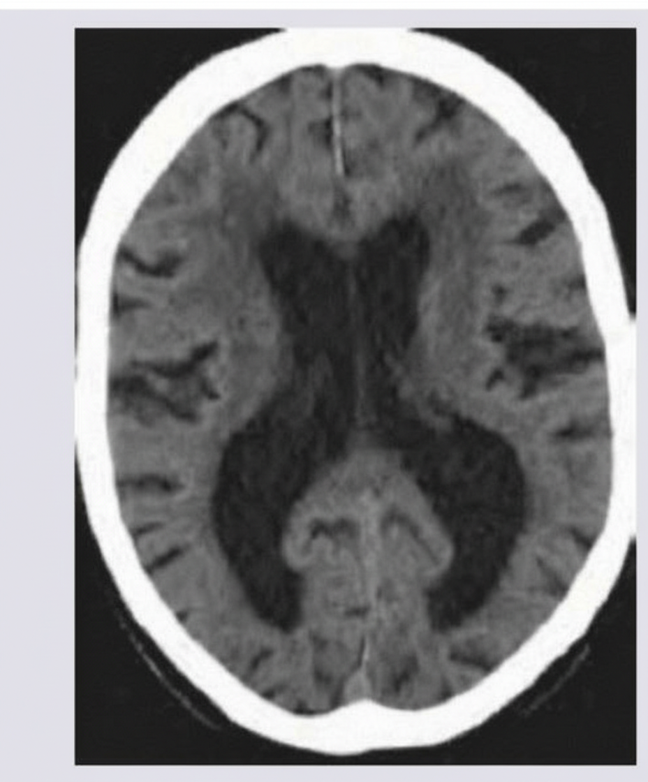 Image for question 87