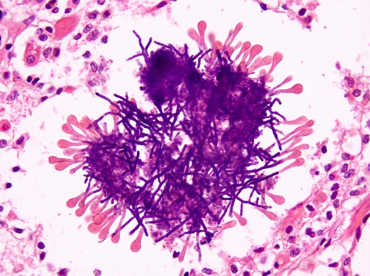 Image for question 1180