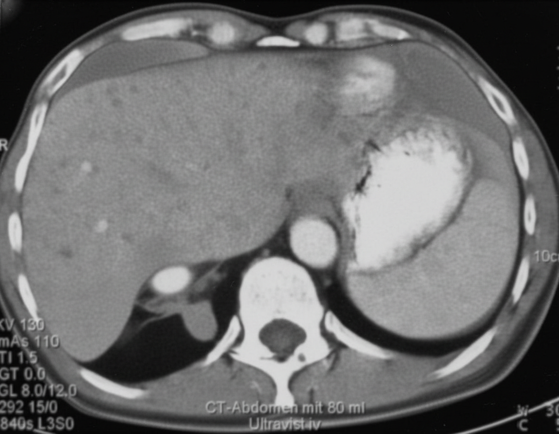 Image for question 236