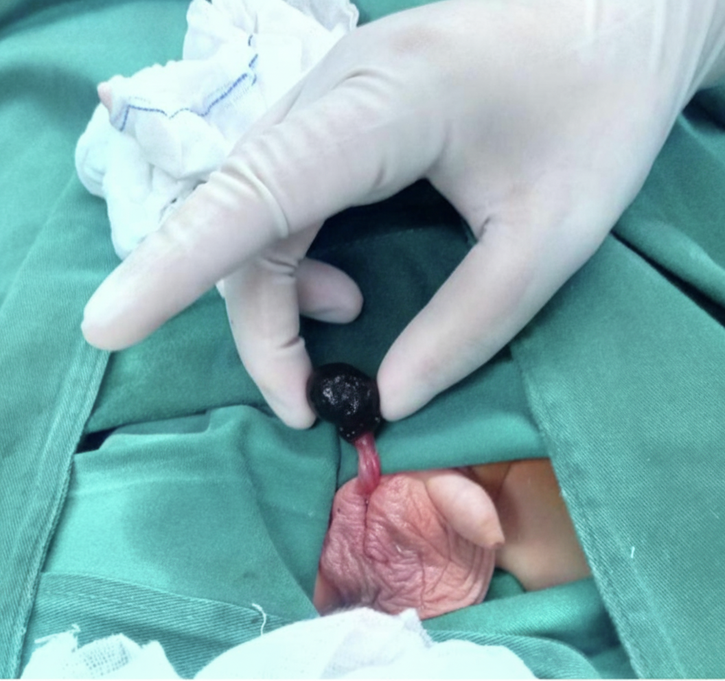 Image for question 145