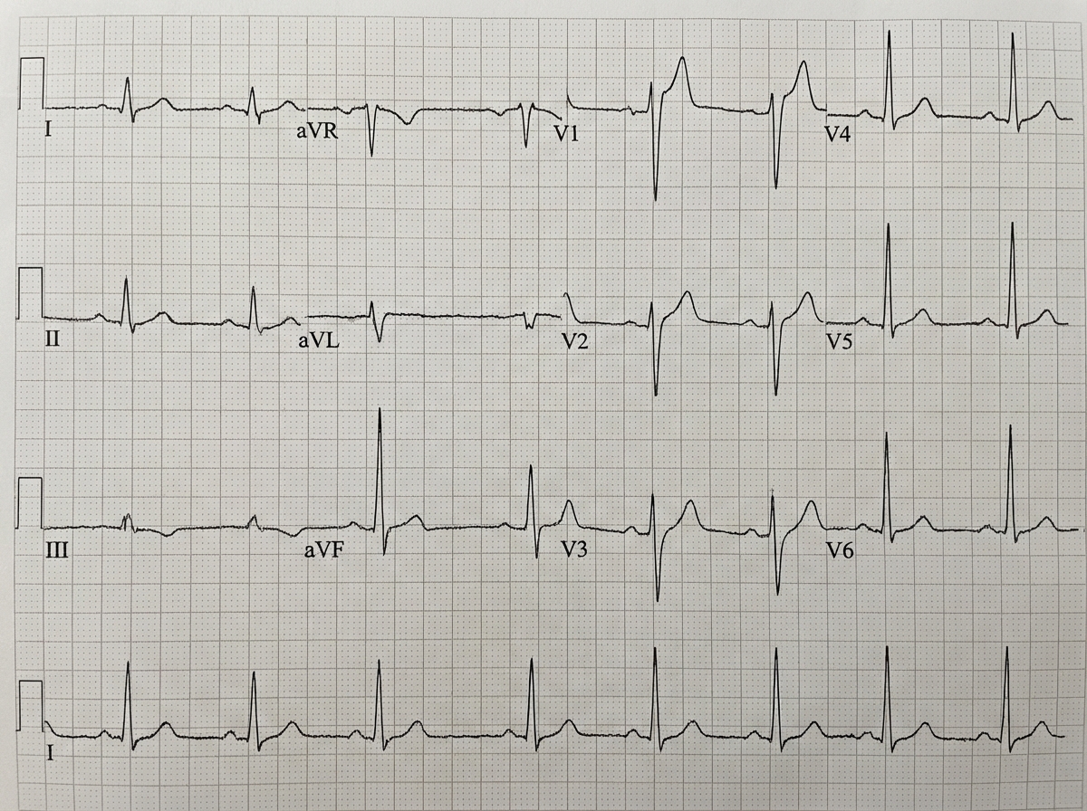 Image for question 549