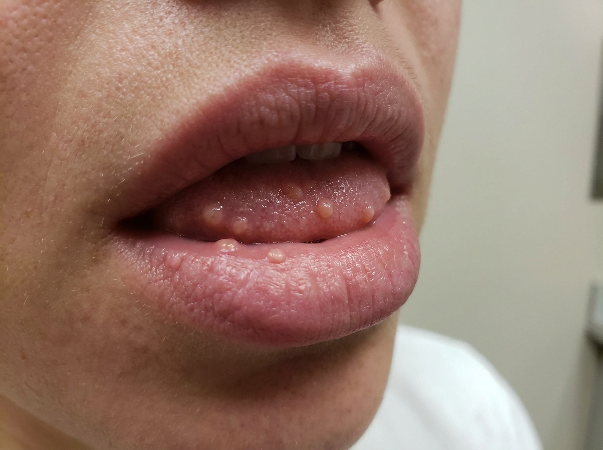 Image for question 65