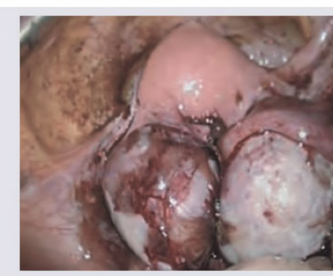 Image for question 790