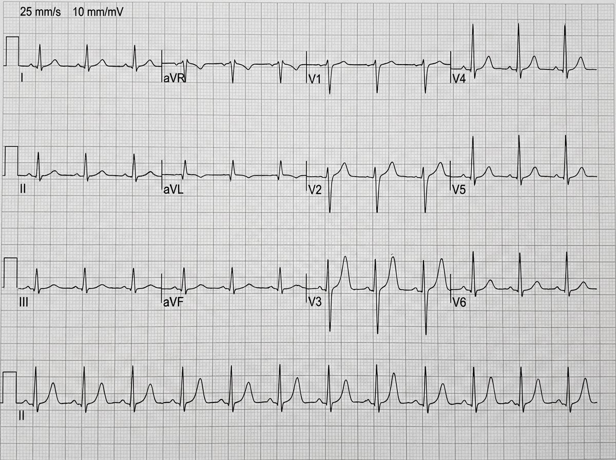 Image for question 32