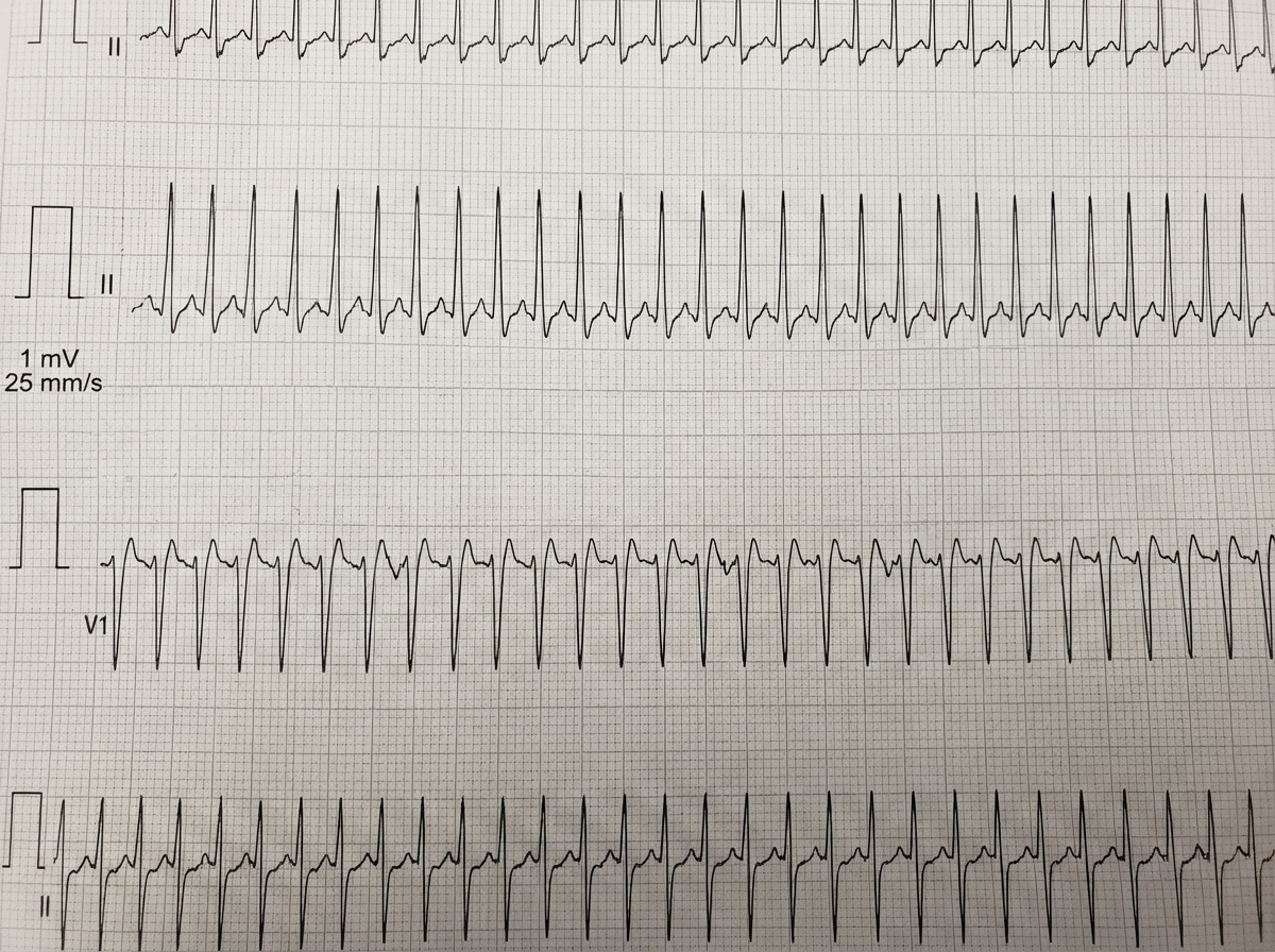 Image for question 616